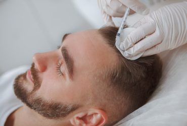 Dermapenli PRP Tedavisi